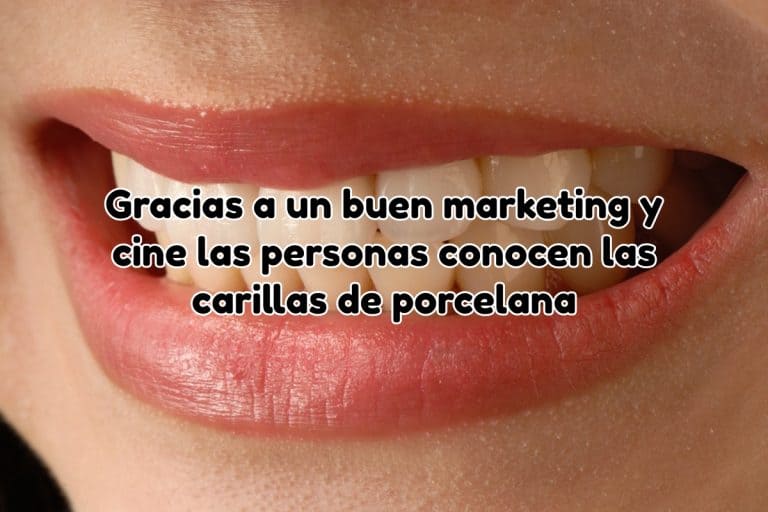 Carillas de porcelana en marketing y cine